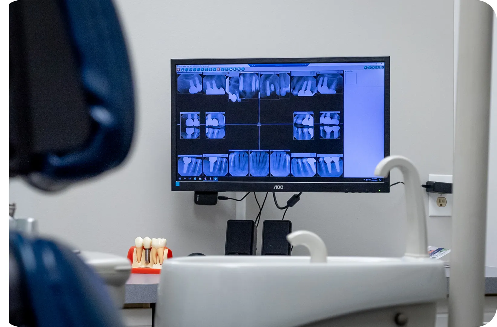 Dental Checkups in Ewing, NJ - dental X-rays